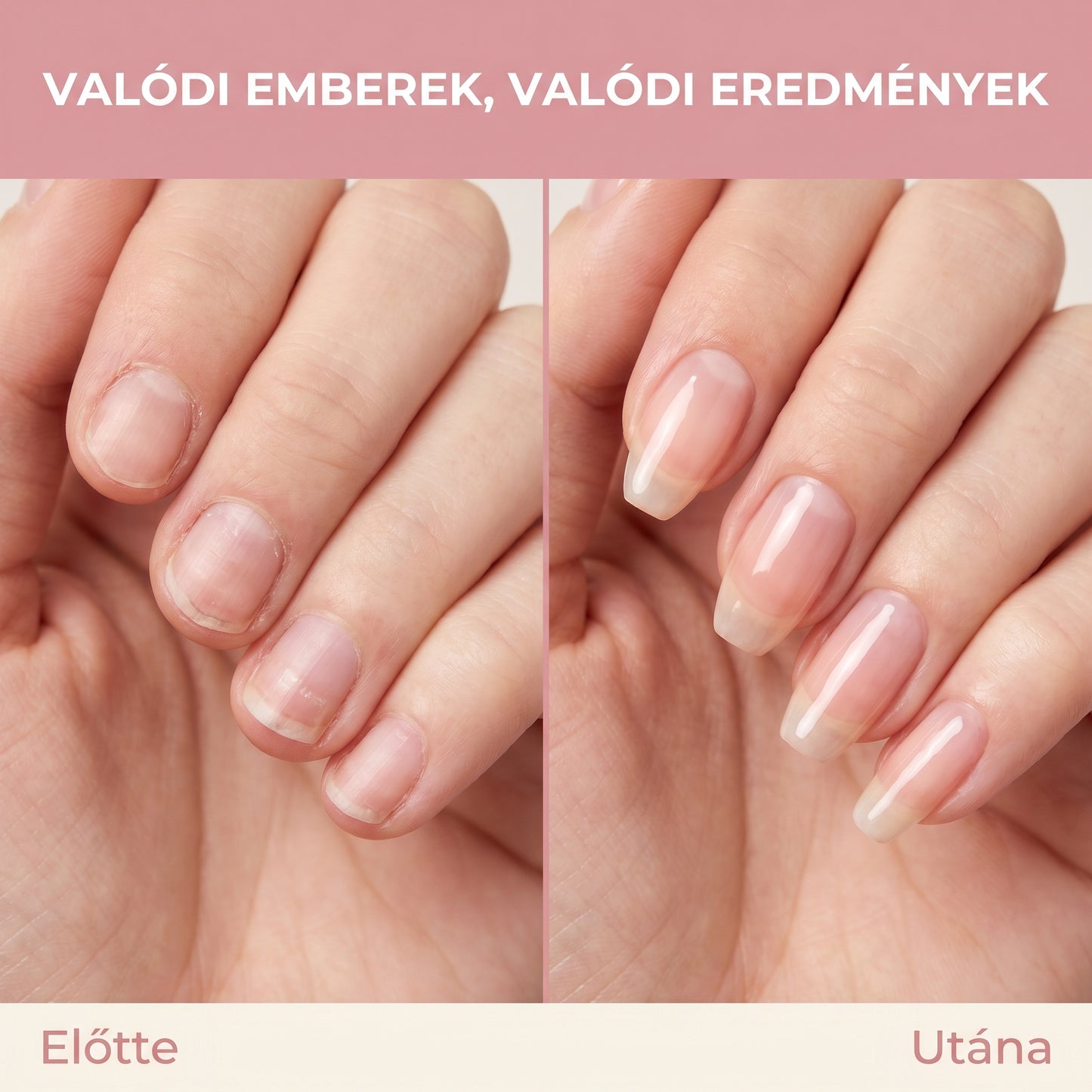 Collagen Harmonia™ előtte utána haj eredmények - kevesebb hajhullás dúsabb haj