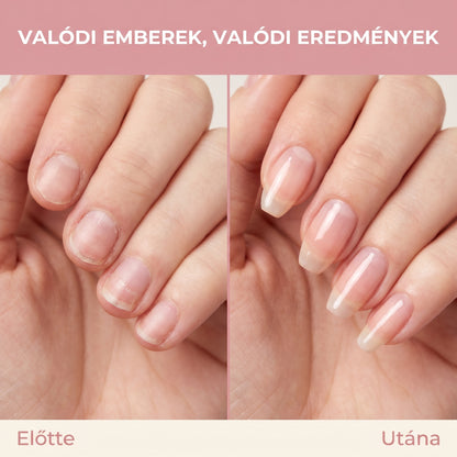 Collagen Harmonia™ előtte utána haj eredmények - kevesebb hajhullás dúsabb haj